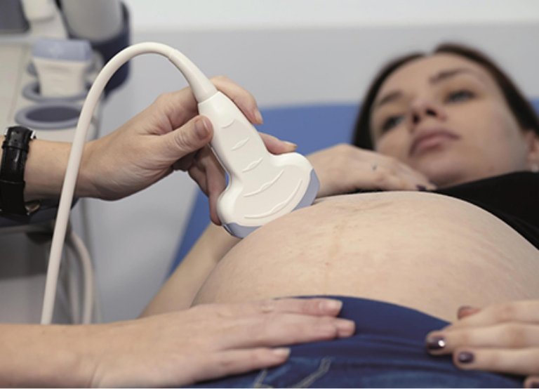 Baby Scan Flintshire